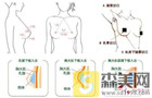 想知道|硅胶隆胸手术疼吗？这个疼痛要维持多久？