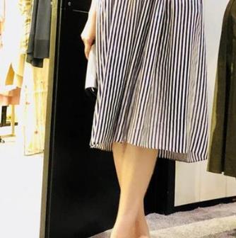 河北医科大学医院美容整形科去疤痕怎么样？要多少钱？真实案例分享