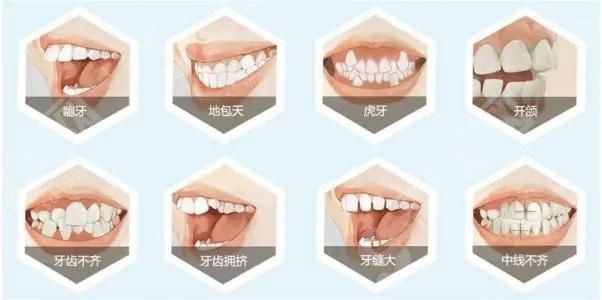 北京海德堡口腔牙齿矫正的果.jpg