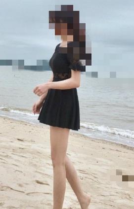 吕金陵医生所做吸脂怎么样？附100天的前后对比图片