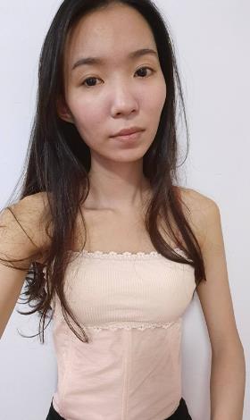刘筱菁医生吸脂技术如何呢？吸脂恢复果图一览