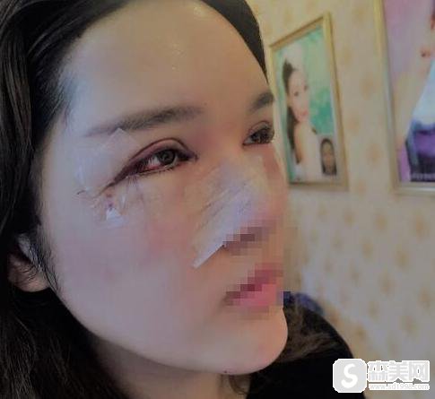 南京医科大学附属明基医院正规吗？整形案例分享+专家介绍