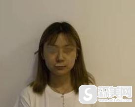 温州市雅美姬医疗美容门诊部?医生信息曝光+附面部吸脂案例前后果对比图!