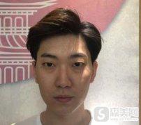 厦门莫琳娜注射瘦脸果，附案例介绍＋较新价格表