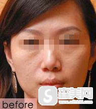 首都医科大学附属北京世纪坛医院整形外科怎么样？口碑分享_专家案例展示！