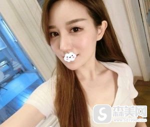 天津维美整形医院的隆鼻果，让我成功地脱离了塌鼻，果很好,案例分享