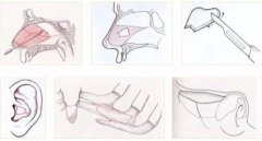 肋软骨隆鼻需要多少钱？附肋软骨隆鼻案例+前后果对比图