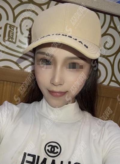 贵美汇医疗美容医院怎么样？贵美汇医疗美容医院做的整形果好不好？附医师介绍及案例分享