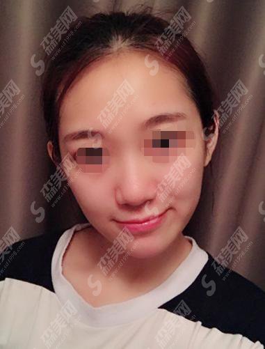 南京施尔美医院怎么样？施尔美做的鼻子怎么样？附施尔美的医师介绍及案例分享