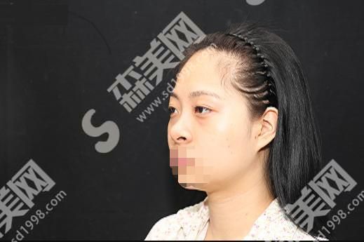 太原丽都摩登整形美容医院怎么样？内含医师介绍及鼻部整形案例分享