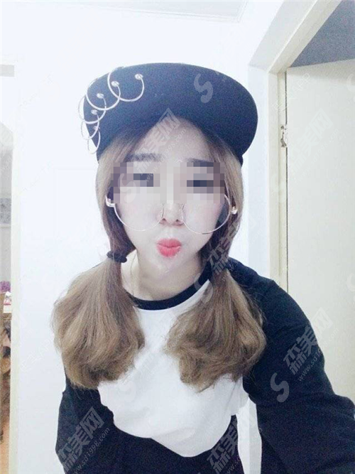 热玛吉新一代一次多少钱?影响价格的因素是什么?