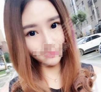 乌鲁木齐兰州军区总医院美容科怎么样？附开眼角果图