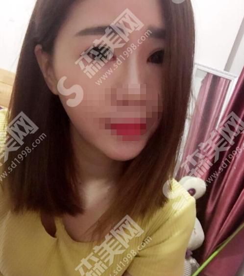 合肥壹加壹美容整形医院正规吗？附案例分享