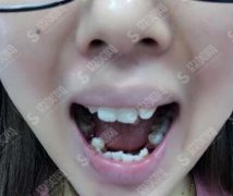 上海长海医院口腔科怎么样？牙齿正畸收费价格出炉啦！