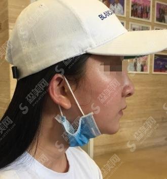 浙一医院做的光子嫩肤怎么样？浙一医院坐诊专家表！