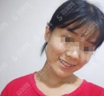 三门峡口腔牙科哪家好？做牙齿美白必须找中心医院口腔科！