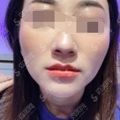 沈阳改脸型中心较厉害医院分享，内附案例果及价格明细
