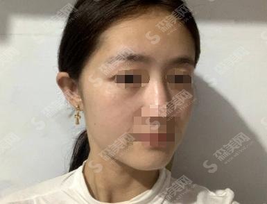 东莞市人民医院医学美容科又火了？医生彩光嫩肤果让人喜欢