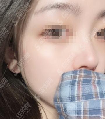 上海华美李健怎样？上海华美整形医院—隆鼻怎么样-医生简介