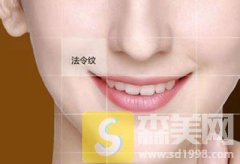 祛法令纹激光好不好？益阳瑞澜整形激光去法令纹真的不得了