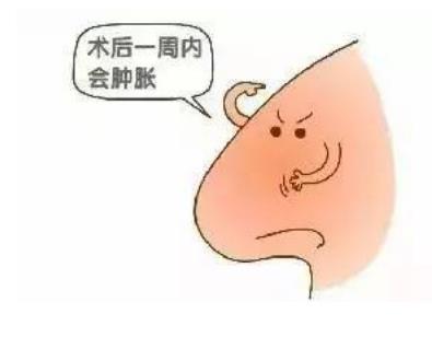 隆鼻术前术后不做好这几件事，极容易导致手术