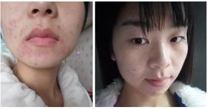 周敏珍医生的擅长项目是什么？介绍和案例展示