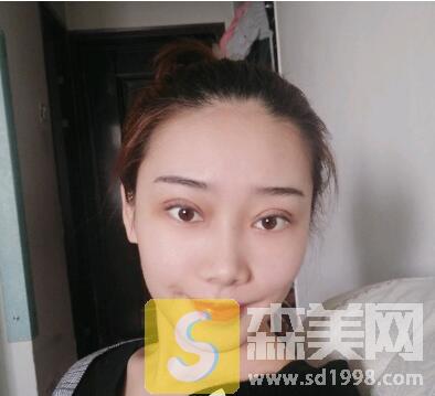 沧州市中心医院整形美容怎么样？内含割双眼皮价格+真实案例+医生名单介绍