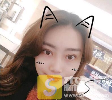 沧州市中心医院整形美容怎么样？内含割双眼皮价格+真实案例+医生名单介绍