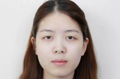 唐都医院李望舟做双眼皮怎么样？真实双眼皮案例分享