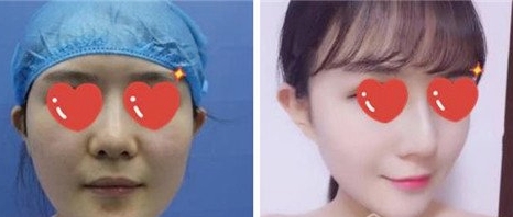 乔爱军教授的相关简介、项目价格和手术风格是什么？