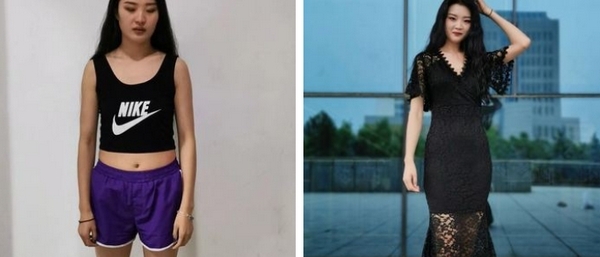 侯典举医生的吸脂技术怎么样？相关简介和项目价格是多少？