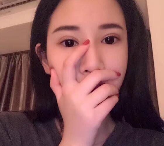 张建军医生的颌面案例好不好？价格和相关案例展示