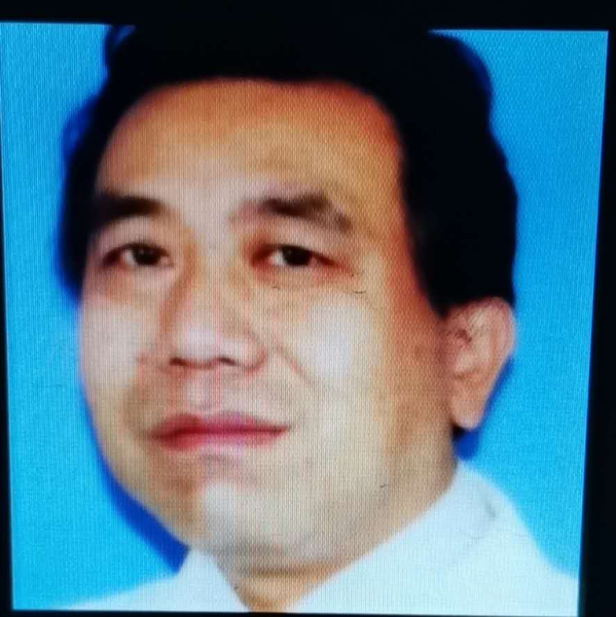 周波主任的隆胸技术怎么样？项目价格和相关案例展示