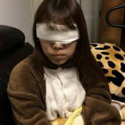 去东田整形做完双眼皮后，果真的直呼太哇塞