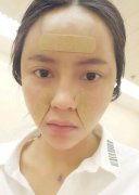 案例分享|自从垫了额头，面包和爱情两丰收