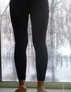 长沙华韩的吸脂瘦腿价格多少钱及相关案例展示