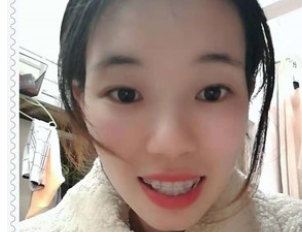 整形专家张兴技术怎么样?榆林市第四口腔科_个人主页_口碑