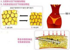 今天，让那些说只能健身瘦腰的健身教练看看，不是只能健身才能减肥