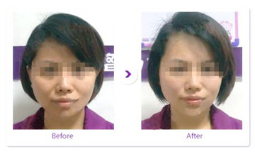 整形专家吴克威到底如何?个人主页和案例展示