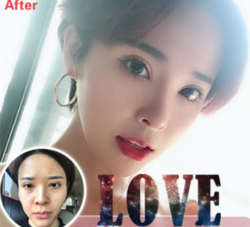 整形专家汪晶到底如何?个人主页和案例展示