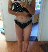 医生给我推荐的大腿吸脂案例后，我也终于下定决心来实现了