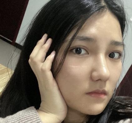 宁波珈禾整形医院任东的信息介绍和案例展示