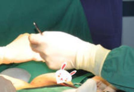 杨大平教授的相关案例和个人信息介绍