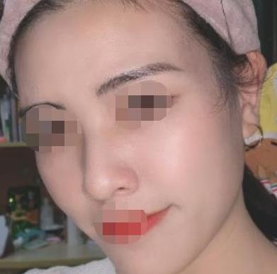 皮肤专家王家欣的个人简介和相关案例