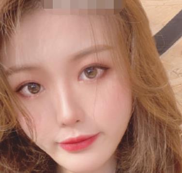 西安整形医生苏鹏的相关简介和案例展示