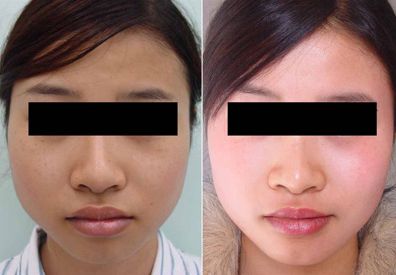 张敏华整形医生个人主页情况?上海万众整形_案例展示_口碑