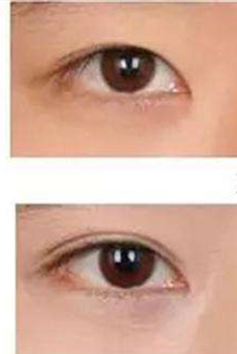 整形医生郑一峰的个人主页情况?案例展示_口碑_上海文峰整形