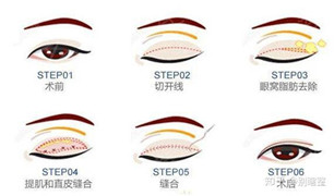 整形医生邹丽剑的个人主页情况?案例展示_口碑_上海一美整形