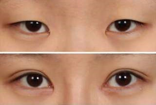 整形医生邹丽剑的个人主页情况?案例展示_口碑_上海一美整形