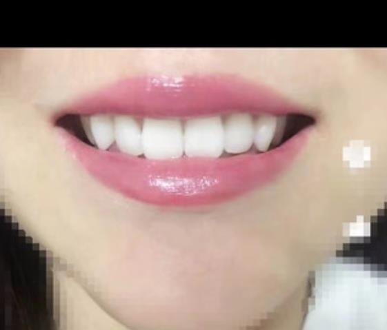 整形医生李靖敏医生口碑如何，案例展示，项目价格-杭州口腔医院